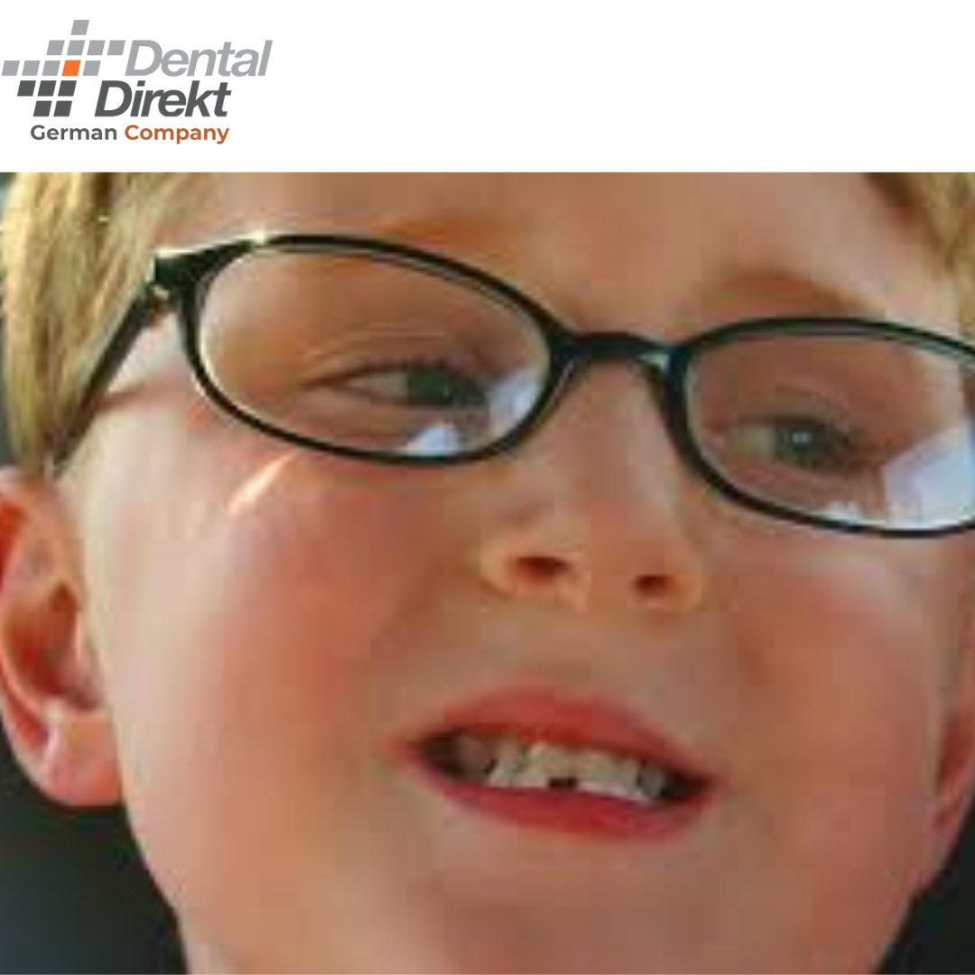 dental_direkt's tweet image. A Piece of Tooth Fell Off! Is That an Emergency?
A chip in a tooth can be so small that the patient doesn’t even notice at first. 
Call us or Whatsapp at 945-945-0606
Visit us - dentaldirektindia.com
.
.
.
#chippedtooth #ChippedTeeth #frontteeth #frontteethgap