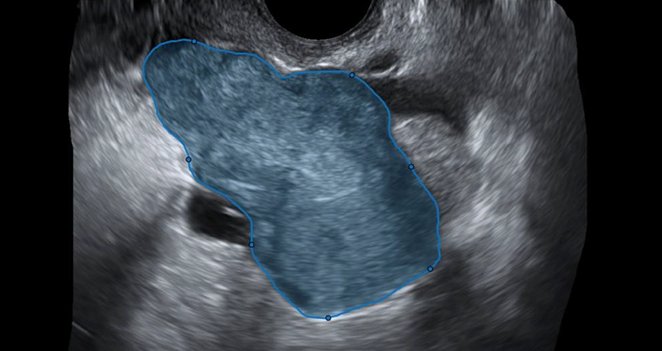 deeptracetech's tweet photo. We are so happy and proud to share the news of the #CE #marking of #TRACE4OC™, our #AI-powered #medicaldevice for #predicting the #risk of #ovarian #cancer.
Read the full press release here:
https://t.co/pss8hkiHx9 https://t.co/4SZ128rxVm