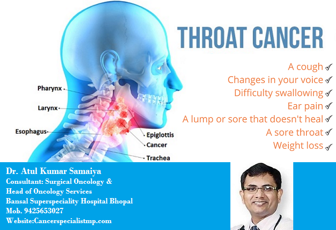 tirzepatide lump in throat Throat Cancer Symptoms & Signs •Sore throat •A lump in your throat •Weight  loss •Voice changes •Trouble swallowing #throatcancer #throatcancersymptoms  #throatcancertreatment #curecancer #cancerhospital #cancersurgeon  #cancersurgery