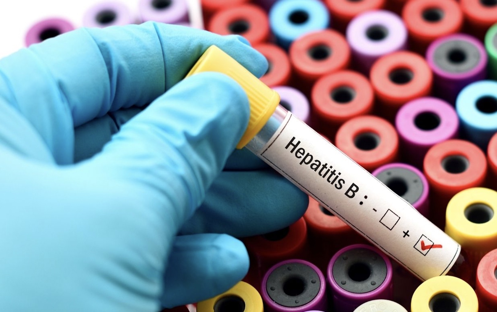 Drug Topics on Twitter "PreHevbrio is the only 3antigen vaccine for