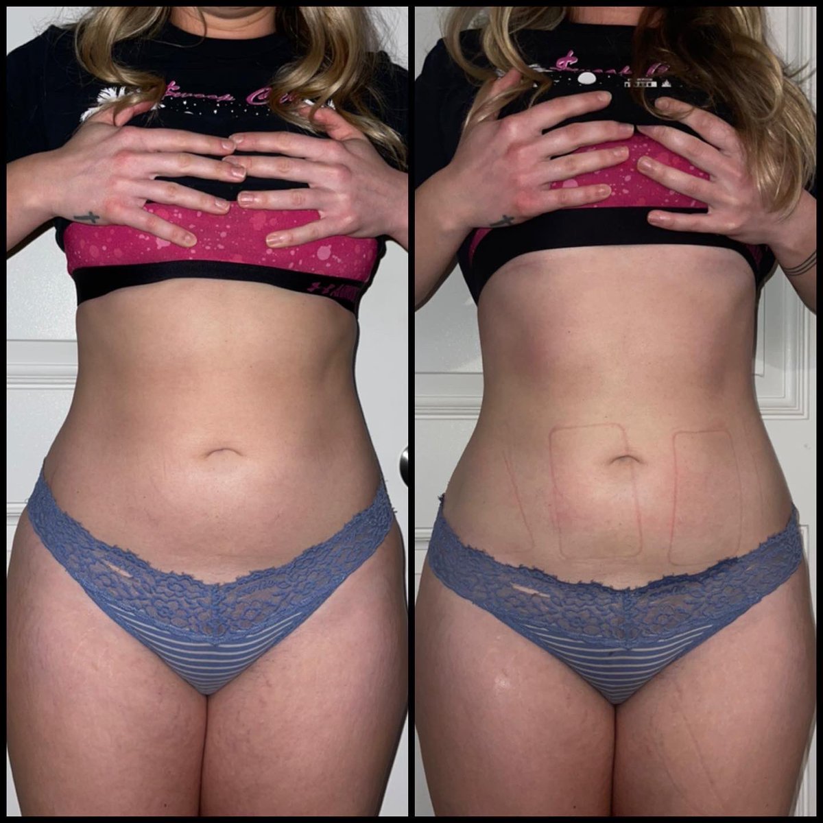 looksbylo's tweet photo. I’m trying to figure out where her waist went 🤌🏾 
- Looks By Lo 💕
#Sacramento #sacramentobodysculpting #bodysculptor #bodysculpting #Noninvasivebbl #sculptor #smallbusiness #sacramentobusiness  #btsoninstagram #looksbylo #bodypositvity #skintightening https://t.co/5PMPFZqqP8