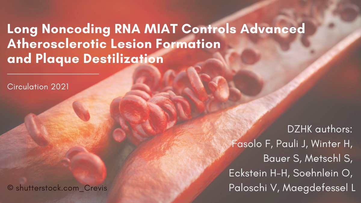 DZHK Germany (@dzhk_germany) on Twitter photo The long #noncodingRNA #MIAT is a key regulator of cellular processes in advanced #atherosclerosis
✨DZHK #PaperOfTheMonth selected and honored by our Board of Directors
📃 <a href="/CircAHA/">Circulation</a> bit.ly/334PVft
@LarsMaeg <a href="/_hannawinter/">Hanna Winter</a> <a href="/TU_Muenchen/">TU München</a> The long #noncodingRNA #MIAT is a key regulator of cellular processes in advanced #atherosclerosis
✨DZHK #PaperOfTheMonth selected and honored by our Board of Directors
📃 <a href="/CircAHA/">Circulation</a> bit.ly/334PVft
@LarsMaeg <a href="/_hannawinter/">Hanna Winter</a> <a href="/TU_Muenchen/">TU München</a>