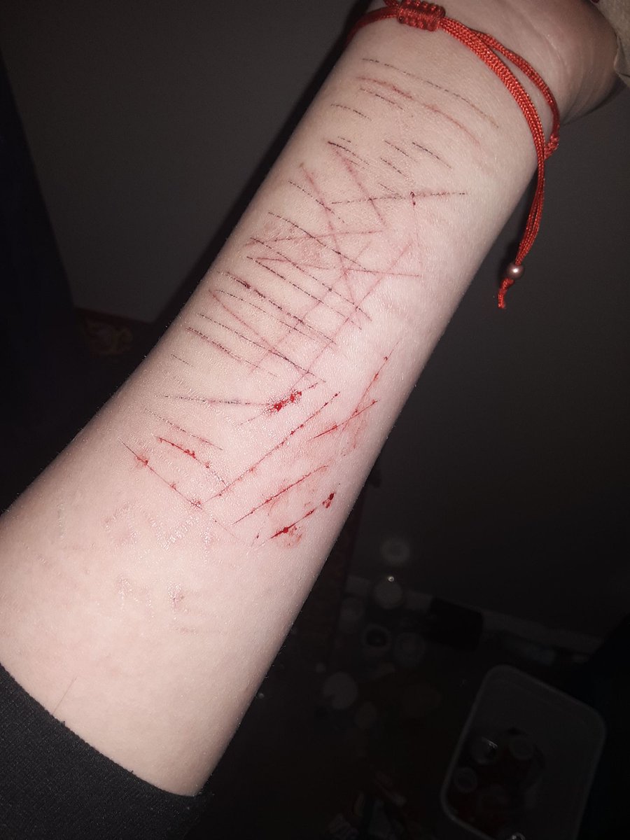 LSER66722307's tweet photo. TW//SH 
.
.
.
.
.
.
.
.
.
.
.
Relapsed again <3
Catscratchestwt sh twt raspberryfilling redbreadtwt sliceytwt Barcodetwt styro https://t.co/uMEnLoQzTU