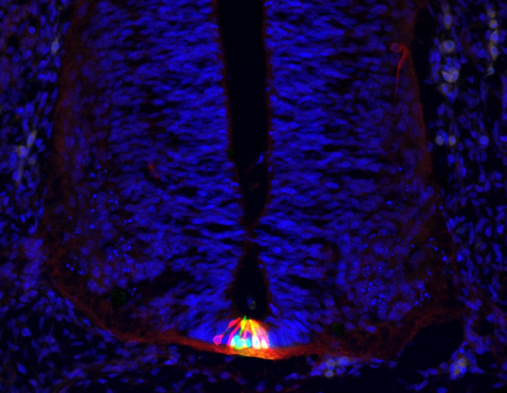 Brain Research Institute tweet media
