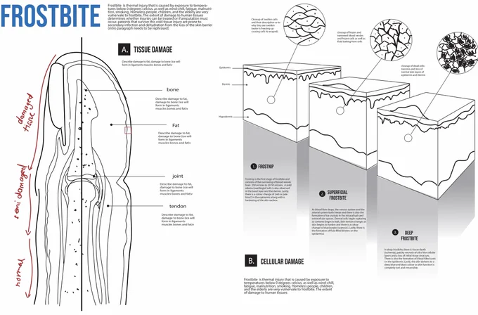 This was my first draft- I knew I wanted to illustrate changes on a more macroscopic level (finger on the left) and cellular level ( tissue cubes on the right) 