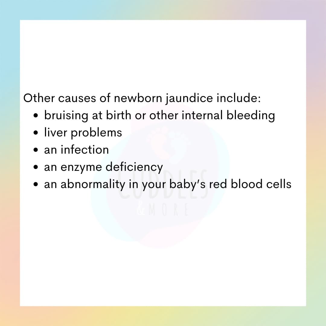CuddlesMore's tweet photo. Jaundice in newborns is common and with early intervention, most can resolved, unless there are more severe underlying issues.

It is important to keep feeding baby, avoid self medication and seek professional medical care as soon as possible #cuddlesandmore https://t.co/wQeE4IAriY