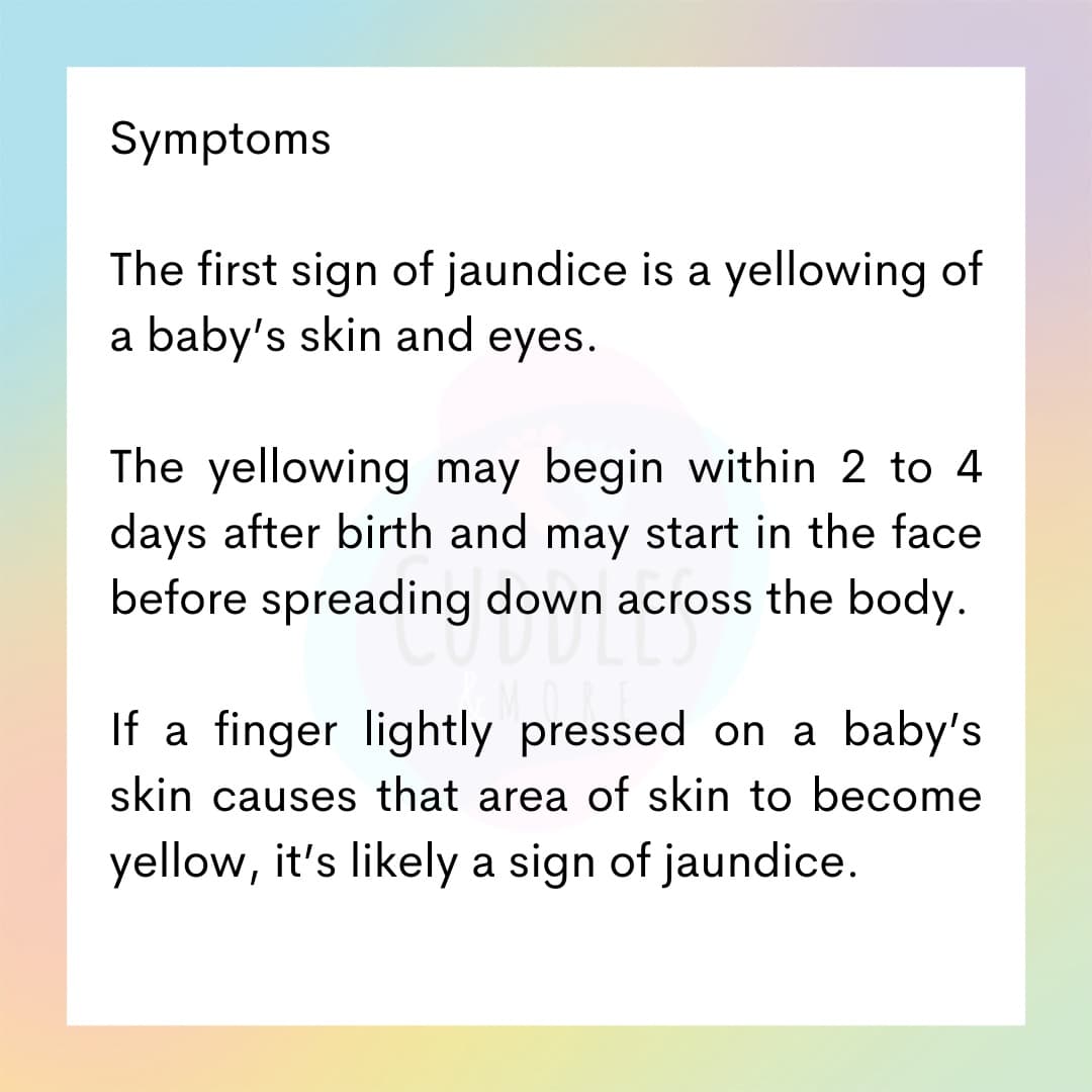 CuddlesMore's tweet photo. Jaundice in newborns is common and with early intervention, most can resolved, unless there are more severe underlying issues.

It is important to keep feeding baby, avoid self medication and seek professional medical care as soon as possible #cuddlesandmore https://t.co/wQeE4IAriY