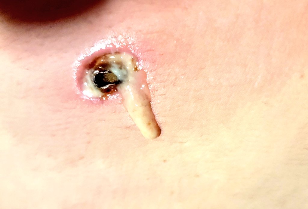 ◤✞­ 𝐎𝐩𝐢𝐚𝐭𝐢𝐜𝐮𝐬 ✞◥ tweet media