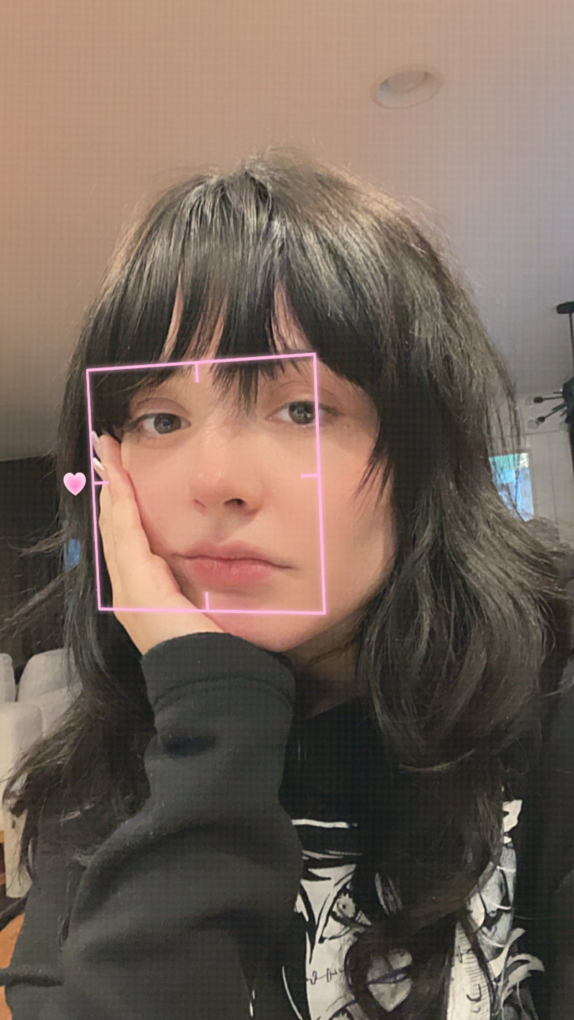 What Does Dry Socket Look Like After Wisdom Tooth Ext vrogue.co