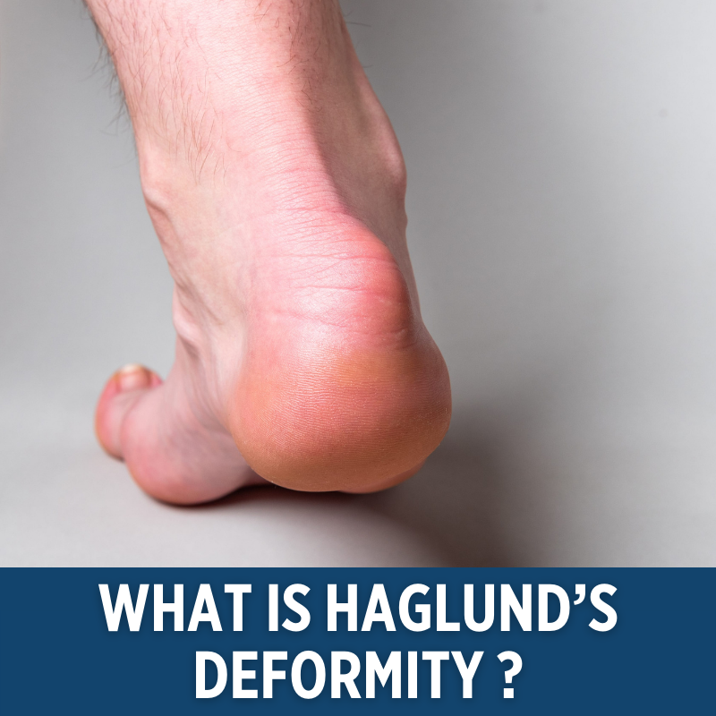 River_Podiatry's tweet photo. Click the link below to learn more.

https://t.co/grH55AIaZY https://t.co/s2OYdr4H6r