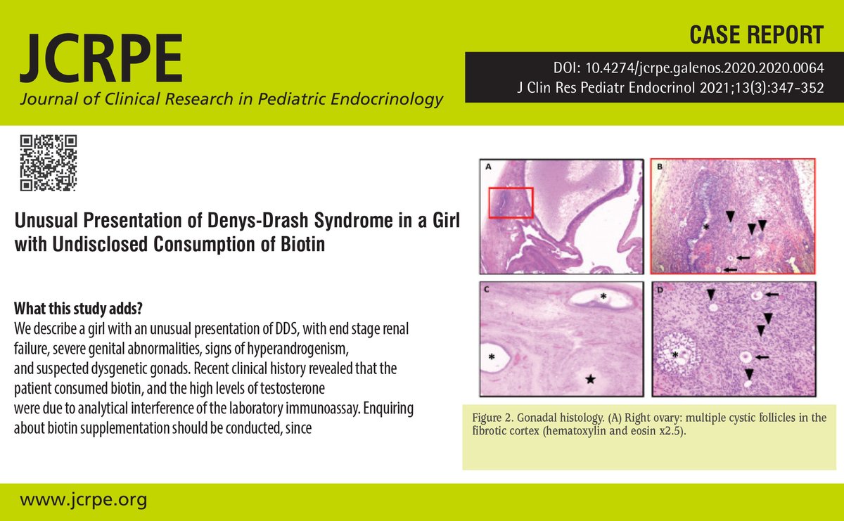 JcrpeOfficial's tweet photo. Unusual Presentation of Denys-Drash Syndrome in a Girl with Undisclosed Consumption of Biotin

A noteworthy and practical message  from : https://t.co/sev8C5j6Cn 

#DenysDrashsyndrome #testosterone #biotin #disorderofsexdevelopment https://t.co/FwyvNcUz1G