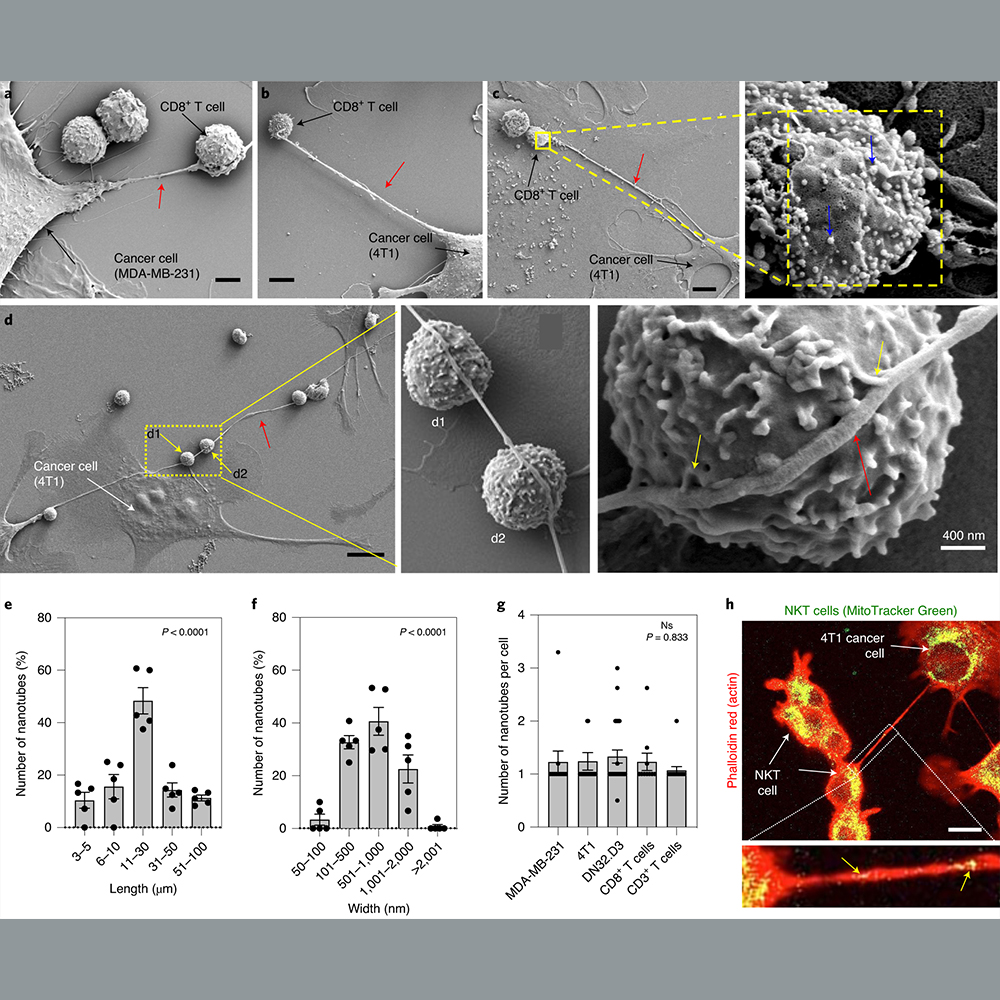 NaturePortfolio's tweet photo. A study in @NatureNano finds that tumour cells can hijack mitochondria from immune cells by forming physical nanotubes and suggests that inhibiting this process might represent a potential immunotherapy approach. https://t.co/mkuFh1fKJo https://t.co/7U3dM8BBt4