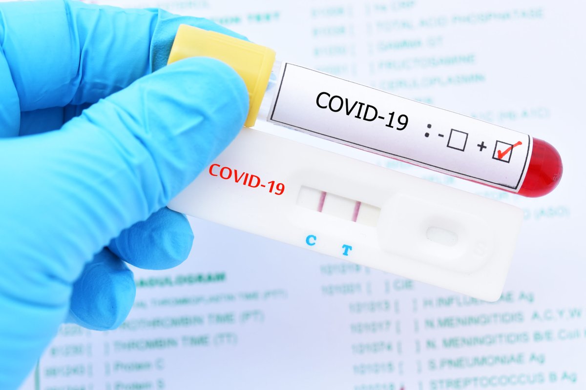 ecuavisa's tweet photo. Ecuador suma 513 nuevos contagios de covid-19 y acumula 525.398 casos. https://t.co/G6xVMQsr72 https://t.co/GqqpHDlhFa