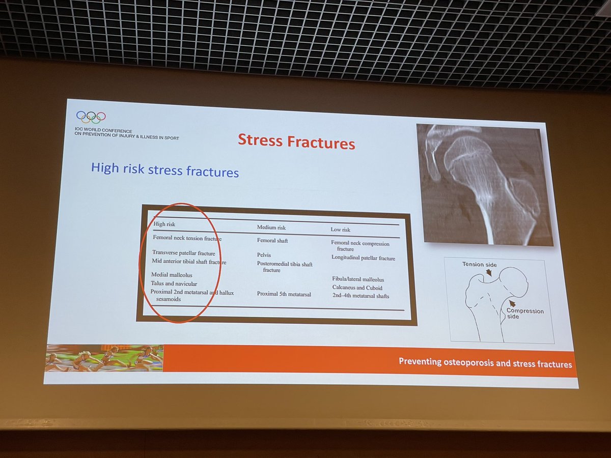 runnerphysio's tweet photo. Great talk by 🇨🇦 @margomountjoy @IOCprevConf in Monaco. 
Know your high risk stress fractures and err on the conservative side when treating! https://t.co/HpF8q7VdNd