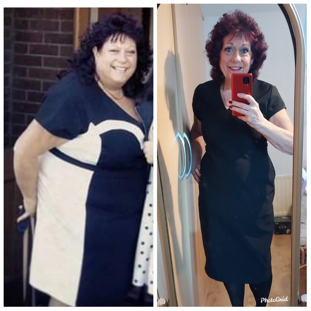 disco_diva59's tweet photo. Less killer whale more slinky seal after loosing 11st.7lb @SlimmingWorld living my best life now ,should have done it 30yrs ago 
#throwbackthursday #weightlosstransformation #slimforlife follow @disco_div59_sw on Instagram for #swmotivation #swinspiration #lovinglife https://t.co/CwXASXzFCk