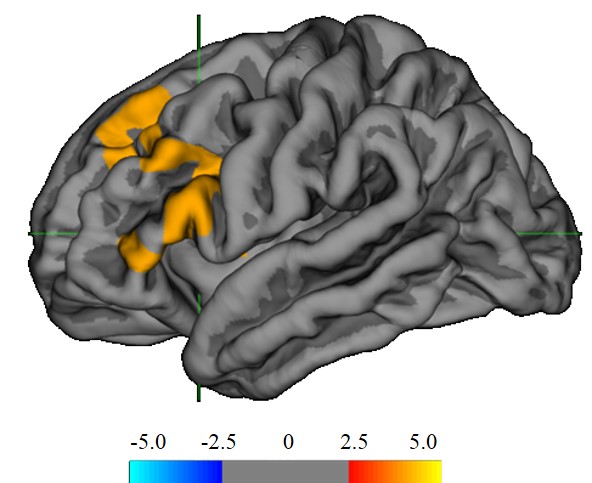 Brain tweet media