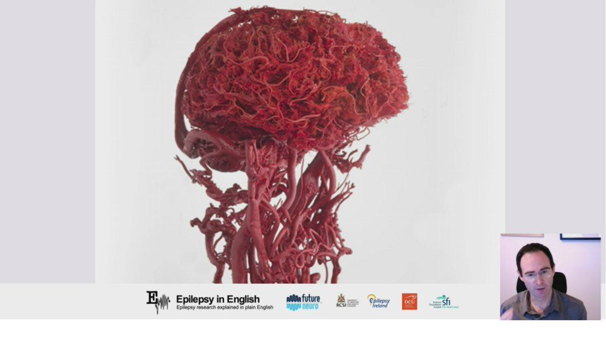 What an image. All the blood vessels in our brain! Speaking about #genetherapy tonight <a href="/mattcampbelltcd/">Matthew Campbell</a> in our <a href="/epilepsyireland/">Epilepsy Ireland</a> workshop. 

@scienceirel <a href="/epilepsyireland/">Epilepsy Ireland</a>
