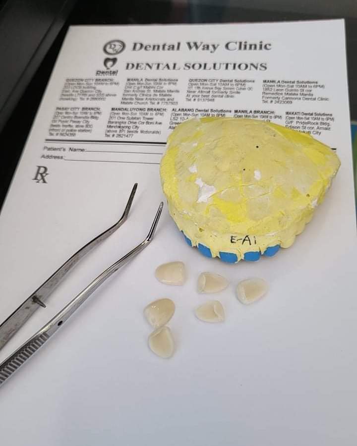 dentalway09's tweet photo. Porcelain veneers available at Dentalway Int'l 

You can also enjoy your porcelain veneers now, pay later! 💳
We are accepting debit and credit card.

 #porcelain #veneers #dentalway #dentalsolutions #braces https://t.co/xsBsCGFpNK