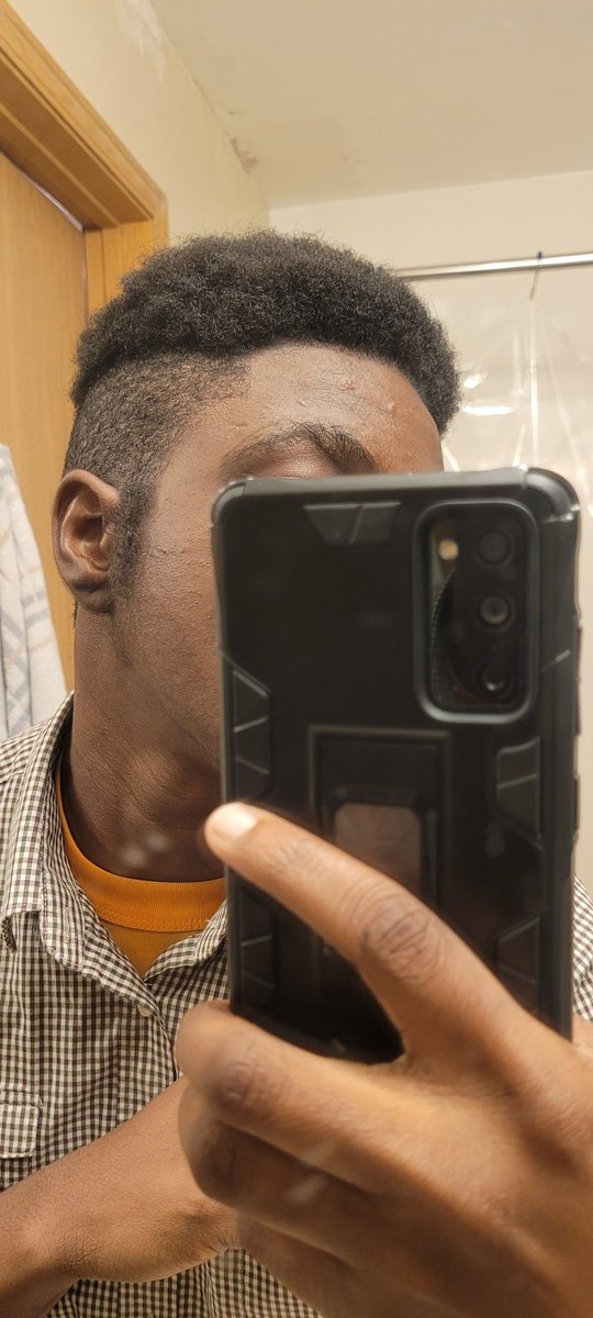 StillTomTommieT's tweet photo. The mental strain&amp;turmoil that is prepping to see my mom after 6 months of growth&amp;change😔
I have the outline of a whole beard now yo! Like wth am I sposed to do to survive seeing her without feeling like I'm betraying myself💔
#SocialTransition #PreT #TransMascTransitionMatters https://t.co/pOmkUow9Pt