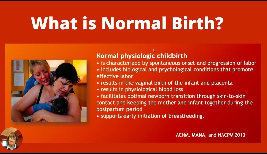GrainneMcSteen's tweet photo. It's less often we get to see this. Very interesting presentation from @sheena_byrom really enjoying all of today's presentations. #physiologicalbirthire https://t.co/y21CnqFFHn