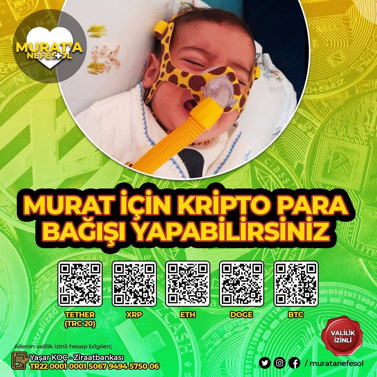 RT lütfen
SMA hastası Murat bebek 16. Ayına girdi. 
Geçen haftaya kadar durumu iyiken 3 gün önce aniden fenalaştı.
Amacımız Murat'ın boğazı delinmeden kaslarını kaybetmeden tedaviye gönderebilmek.
Valilik izinli banka hesapları ve kriptopara yardım hesapları bir sonraki tweette
+