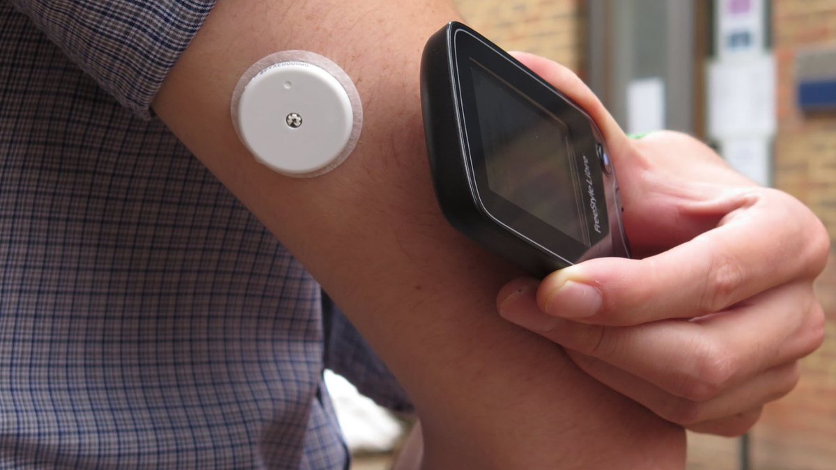 JDRF is delighted with NICE's draft guidelines that recommend all adults with #type1diabetes are offered a choice of flash or continuous glucose monitoring. Read more about what this means for people with #type1 bit.ly/30Z0sHQ #GBDoc