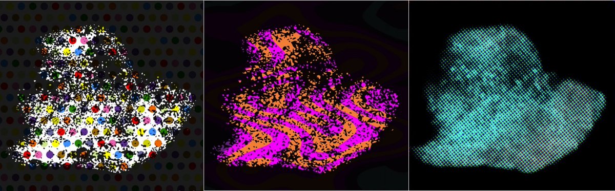 MairaTampakaki's tweet photo. Look at our little heart shaped fella! 
This lovely #tumoroid inspired some #popart work today at the #lab!
#cellbiology and #hybridmicroscopy at their best!😀

@AcademicChatter @PhDForum https://t.co/9Zt9n5f6Ou
