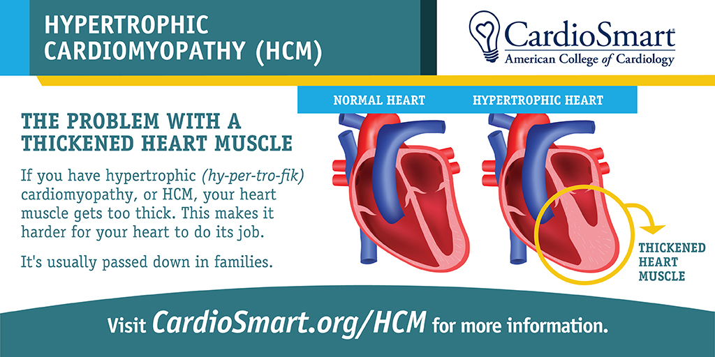 If you have a 1st-degree relative w/ hypertrophic cardiomyopathy (HCM), your 👩‍⚕️ may recommend you get screened for the condition. Screening through a genetic or heart imaging test helps monitor those who may need treatment. Learn more: bit.ly/3o6jPVV #FamilyHealthHistory