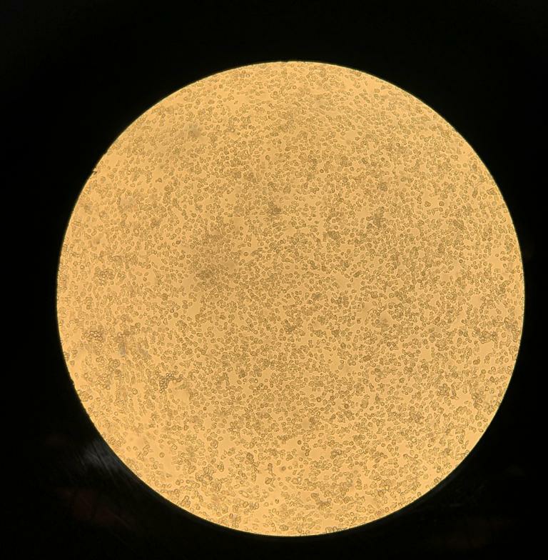 GenomicaP's tweet photo. 👉🏼Acanthamoeba genotipo T4. 

El genotipo T4 es el más común tanto en el ambiente como en aislados de individuos con patología.

Es el genotipo en el cual se han descrito más casos de infección en humanos.

-Captado por el equipo de investigación de Genómica de Protozoarios- https://t.co/j4fVeS1O9V