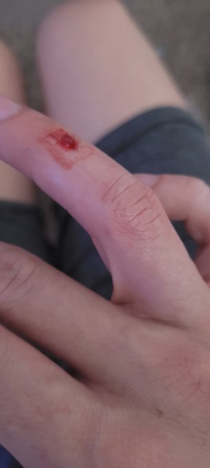 Just had an entire lava lamp do a thwomp on my right ring finger.

It isn't broken, but holy fuck was