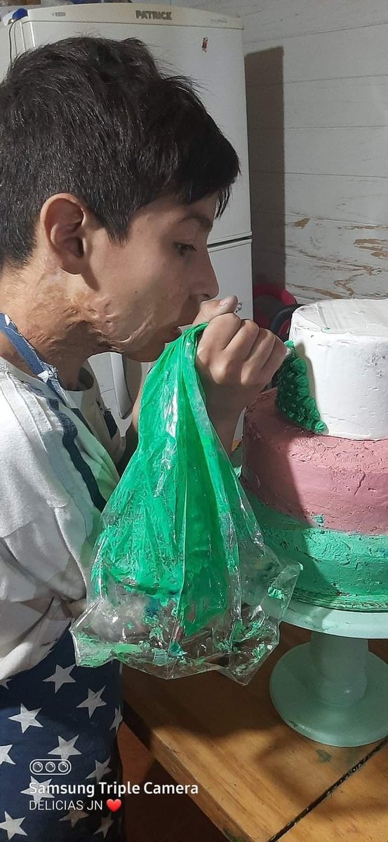 AMOR DE HIJO: JOAQUIN TIENE 10 AÑOS Y HACE TORTAS PARA AYUDAR A SUS PADRES
Aprendió solo a cocinar y decorar,ahora organizó una rifa para comprarse una batidora
Joaquín tiene 10 años y cuando tenía seis sufrió un grave accidente en su casa por el que terminó con 25% de su cuerpo