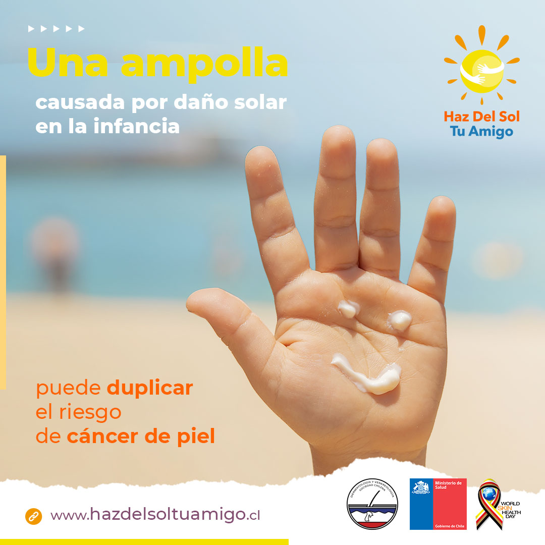 Sochidermv's tweet photo. ¿Sabías que  basta una quemadura con ampollas en la infancia para duplicar el riesgo de cáncer de piel en la vida adulta?  Por eso debemos tomar consciencia y proteger nuestra piel y la de nuestra familia para prevenir el #cáncerDePiel #HazDelSolTuAmigo https://t.co/Uq18olxVGP