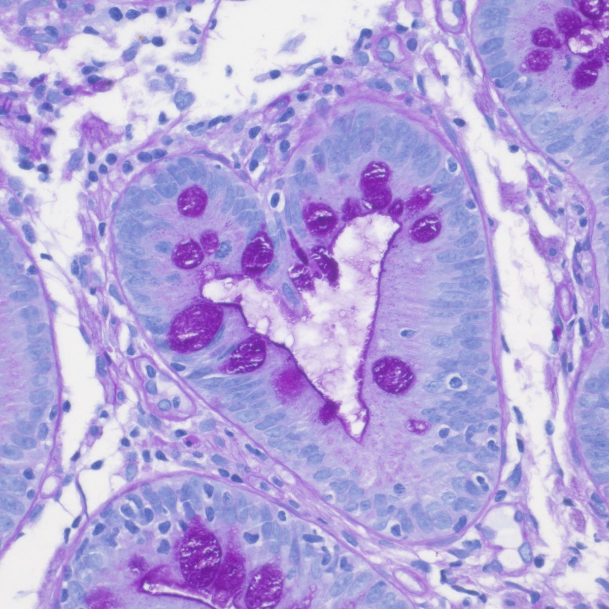 Pathologie_MedUniWien tweet media