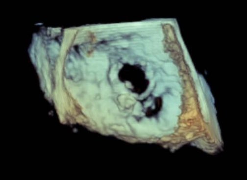 Hemodinamica Torrevieja tweet media