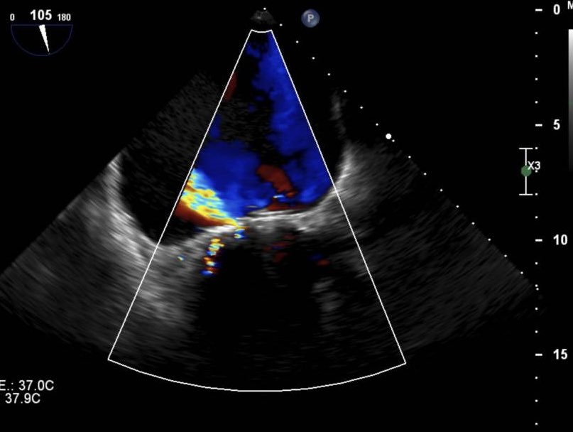Hemodinamica Torrevieja tweet media