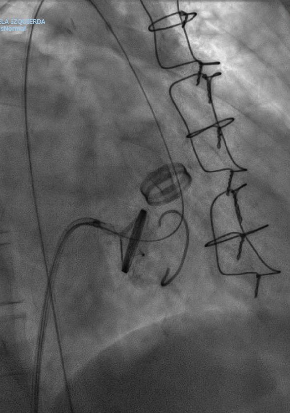 Hemodinamica Torrevieja tweet media