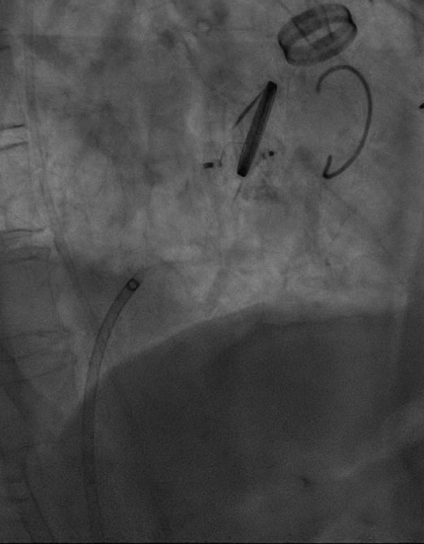 Hemodinamica Torrevieja tweet media