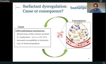 Great work from BTS med student award winner Alastair Watson: lipidomics and proteomics shows dysregulation of lung surfactant proteins and lipids which is potentially targetable in COPD 
<a href="/drbunsenhoney/">Karl Staples</a>
@profwilk