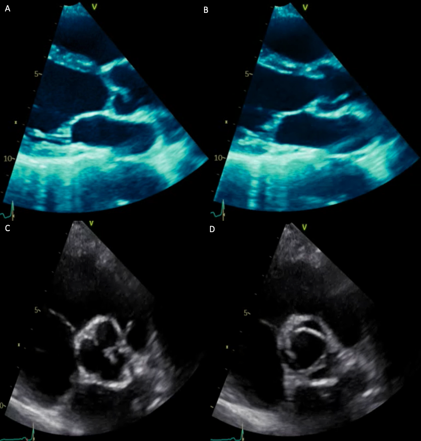 BSEcho's tweet photo. We asked Dr Andy Potter, Co Editor of our ECHO journal, to select a couple of interesting scan images for #NovMember from past issues of ECHO journal which is free to all members! Access the archives here: https://t.co/Z09A65RtMP

Check back in 24 hours for the answer! https://t.co/VwQ0iQRnc0