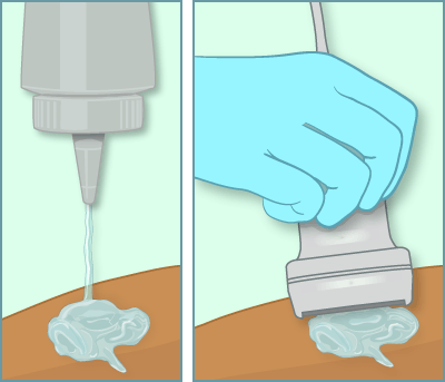 Information On Renal Ultrasounds for Kids 

Learn more: 1l.ink/SLJ53WN

#TheUltrasoundCentre #Warman #Saskatoon #Rosthern #MedicalDiagnosticImagingCentre #MedicalImagingCentre #MedicalCentre #MedicalOffice #Ultrasound #LocalRadiologists