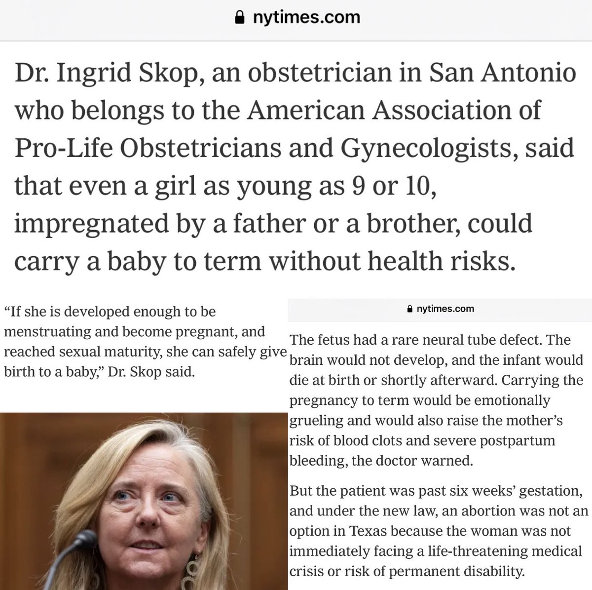 TheTNHoller's tweet image. Dr. Ingrid Skop, speaking in favor of the GOP abortion bans: “Even a girl as young as 9 or 10, impregnated by a father or brother, could carry a baby to term without health risks.” 

Barbaric. nytimes.com/2021/11/26/hea…