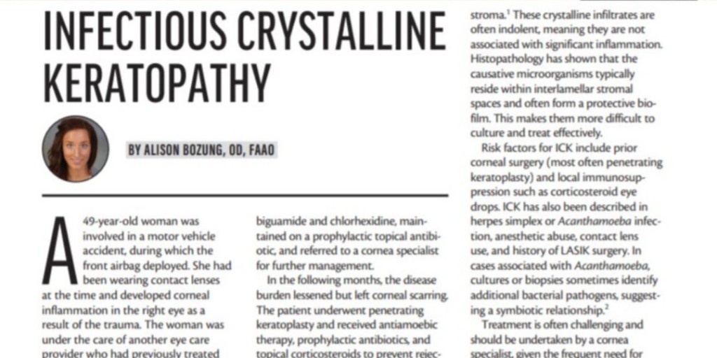 Well, this is not something you see every day! 

#IntrepidEyeSociety member, Alison Bozung OD, FAAO presents a challenging Infectious Crystalline Keratopathy case in Modern Optometry. 

Link for this very interesting case-- 
ow.ly/jkYP50GSCE6

<a href="/ModOptometry/">Modern Optometry</a> 
#optometrist