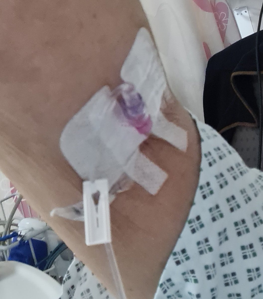 no1sunkfarmer's tweet photo. I'm at home and after having an exploratory angeogram the cameras found nothing wrong with my arteries except one small build up colosestril and didn't require stents so my treatment continues to be #pillpopping for the foreseeable. Thanks for the messages means a lot. https://t.co/wWsXh4F9fo
