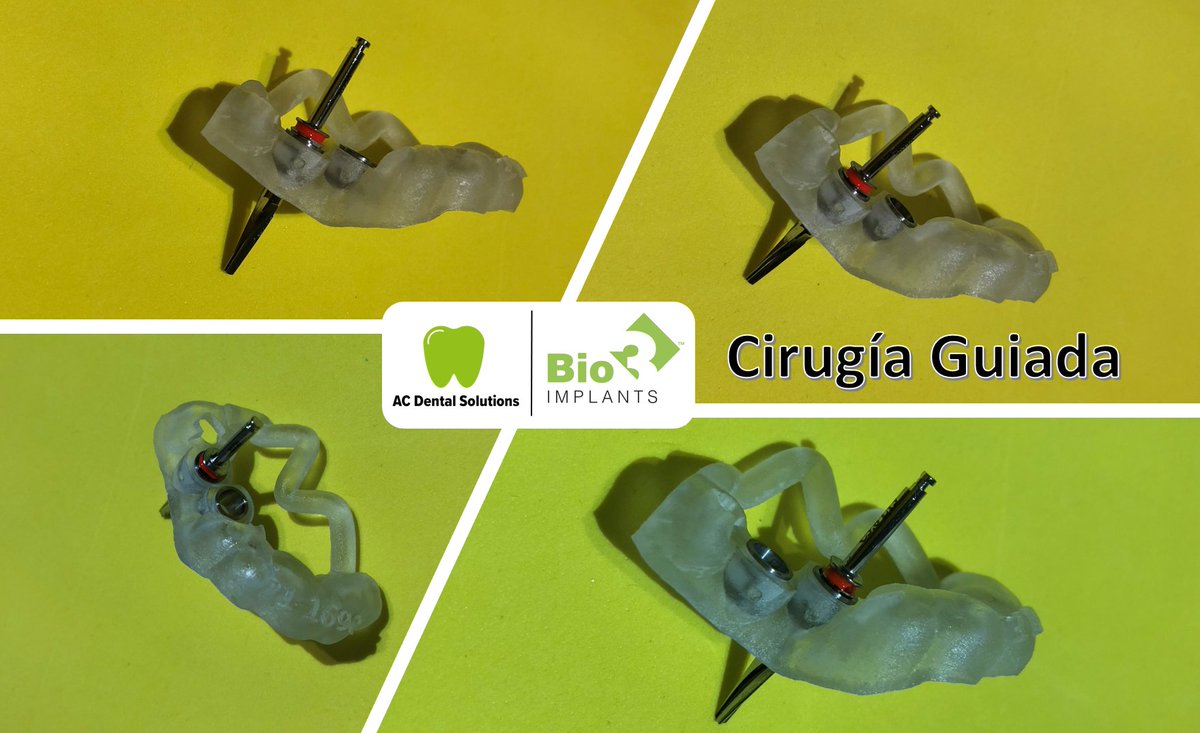 acdentalsolutio's tweet photo. Cirugía Guiada con Bio3 Implants:
TC del paciente, escáner intraoral, planificación de implantes, fabricación de guía quirúrgica y uso del kit #Bio3, aparte del conocimiento y colaboración de clínicos y colaboradores durante el proceso.
#acds #implantes #flujodigital #trend https://t.co/NtGrimcAdB