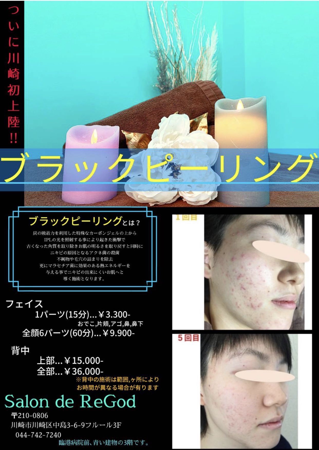 川崎脱毛 Twitter Search Twitter