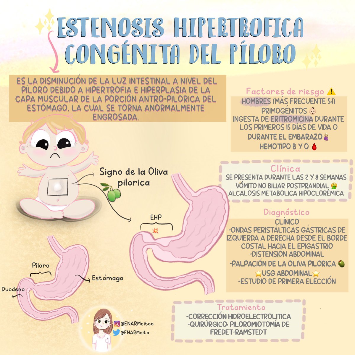 ENARMcito's tweet photo. 🧸 Estenosis Hipertrofica Congénita del Píloro. 
#Pediatría #ENARM https://t.co/tQXylRcqhA