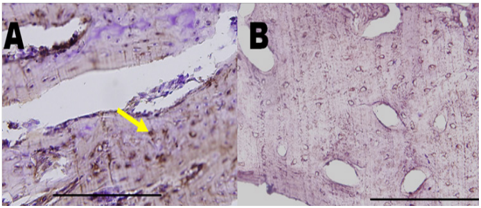 drchrisnorris's tweet photo. Great open access mini review of muscle architecture changes resulting from training #pennationangle #fascicle #hypertrophy https://t.co/M3aC4Bwngd https://t.co/5We4zQpJRN
