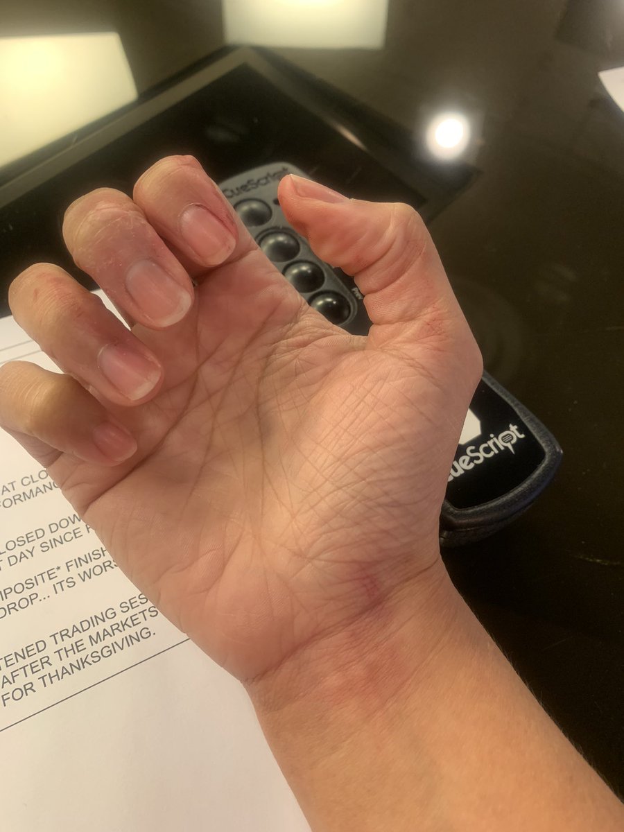 ShellyeLeggett's tweet image. Dropped my lipstick…and after washing my hands 5 times, my fingers are still stained red 🥴🤦🏽‍♀️ #thatnewslife #anchorlife #anchorproblems