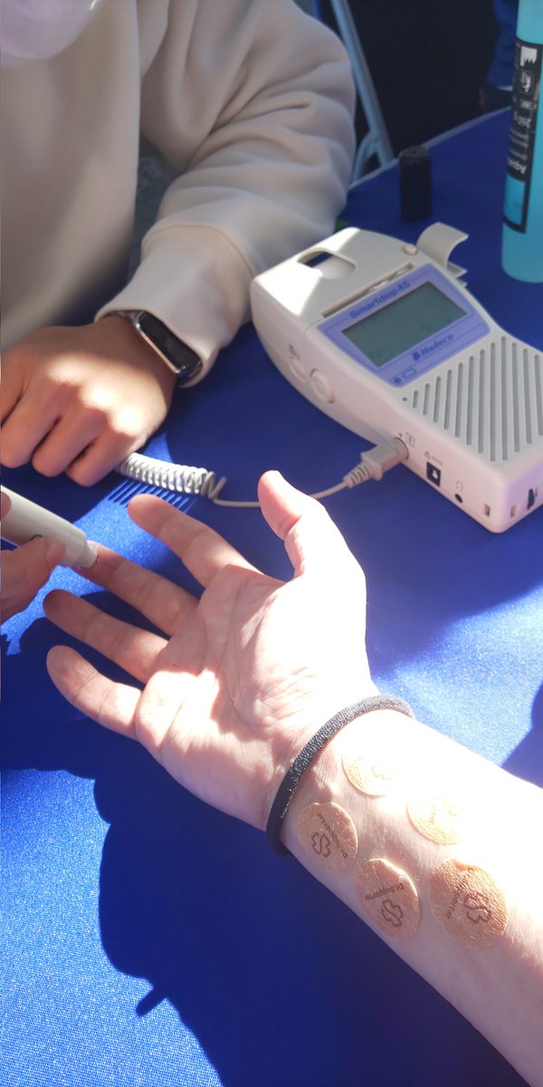 AntlersLive's tweet photo. 【鳥栖戦】Dr.Supporterで血流を測ってもらいました。シールを貼る前は0.9だったのが、シールを貼った後は4.9になりました。(何の値か分からないけど) #鹿島アントラーズ https://t.co/jU7p076Fll