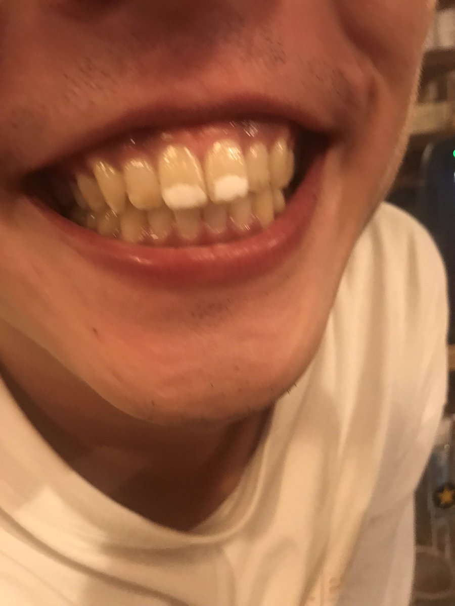 わたなべりょうわたなべ・亮 (@gg9M9KZsdZ0zlS1) / Posts / X